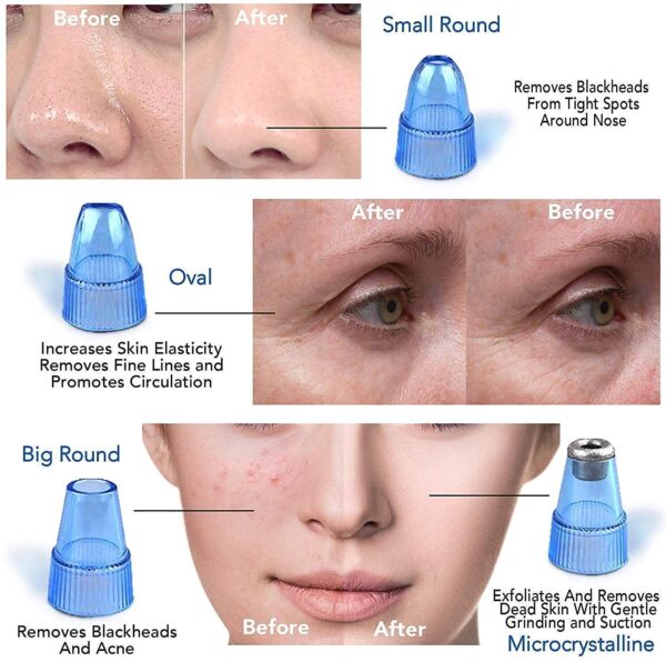 Апарат за чистење лице DermaSuction - Image 4